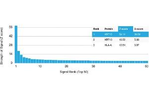 Analysis of Protein Array containing more than 19,000 full-length human proteins using Cytokeratin 15 Mouse Monoclonal Antibody (KRT15/2958).