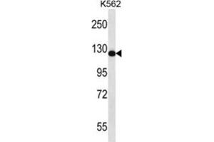 Western Blotting (WB) image for anti-RAS Protein Activator Like 2 (RASAL2) antibody (ABIN2997065) (RASAL2 anticorps)