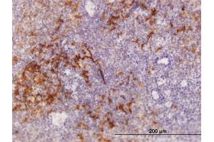 Immunoperoxidase of purified MaxPab antibody to TRAF1 on formalin-fixed paraffin-embedded human tonsil.