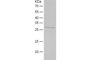 Western Blotting (WB) image for Propionyl CoA Carboxylase beta Polypeptide (PCCB) (AA 7-266) protein (His tag) (ABIN7124602) (PCCB Protein (AA 7-266) (His tag))