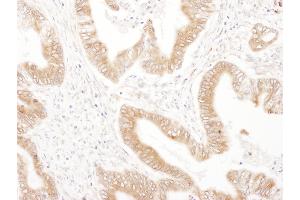 Immunohistochemistry (IHC) image for anti-Ribophorin II (RPN2) (AA 350-400) antibody (ABIN7455016)