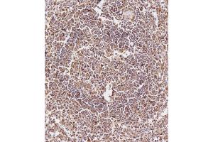 Immunohistochemical analysis of (ABIN657900 and ABIN2846851) on paraffin-embedded Human spleen tissue.