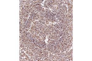 Immunohistochemical analysis of (ABIN657900 and ABIN2846851) on paraffin-embedded Human spleen tissue. (CD163L1 anticorps  (C-Term))