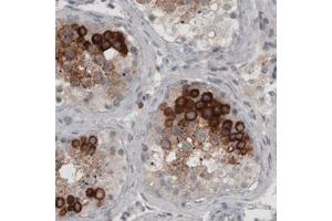 Immunohistochemical staining (Formalin-fixed paraffin-embedded sections) of human testis with LY6K monoclonal antibody, clone CL2435  shows strong cytoplasmic immunoreactivity in a subset of cells in seminiferous tubules. (Ly6k anticorps)