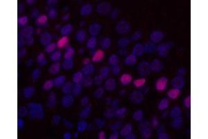 Immunofluorescence analysis of paraffin-embedded rat brain using c-Fos Monoclonal Antibody at dilution of 1:400.