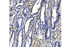 IHC analysis of Aurora A/AURKA using anti-Aurora A/AURKA antibody (ABIN7600751). (Aurora A anticorps  (AA 23-403))