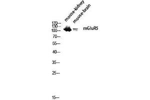 Western Blot (WB) analysis of Mouse Kidney Mouse Brain lysis using mGluR5 antibody.
