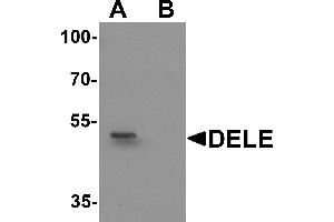 Western blot analysis of DELE in rat brain tissue lysate with DELE antibody at 1 µg/mL in (A) the absence and (B) the presence of blocking peptide. (DELE1/KIAA0141 anticorps  (N-Term))