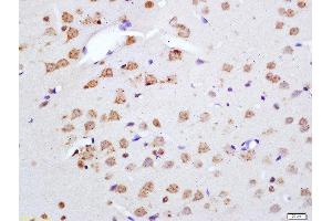 Formalin-fixed and paraffin embedded rat brain labeled with Anti-Phospho-Merlin(Ser518) Polyclonal Antibody, Unconjugated  at 1:200 followed by conjugation to the secondary antibody and DAB staining (Merlin anticorps  (pSer518))