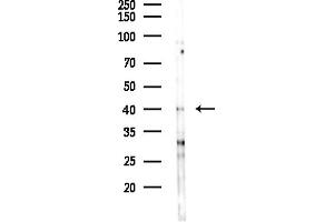 Western blot analysis of lysates from COLO205 cells(UV,30 min treatment), using CDC Antibody at 1/1000 dilution.