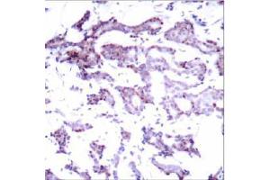 Image no. 1 for anti-ELK1, Member of ETS Oncogene Family (ELK1) (Ser389) antibody (ABIN197160)
