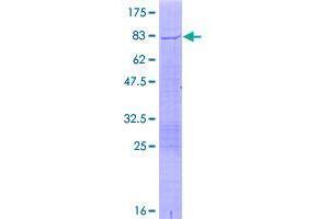 Image no. 1 for TRIM17 / RNF16 (TRIM17) (AA 1-477) protein (GST tag) (ABIN1323615)