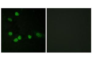 Immunofluorescence analysis of HeLa cells, using Raf1 (epitope around residue 621) antibody. (RAF1 anticorps  (Ser621))