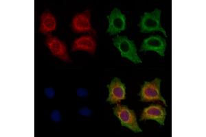 ABIN7094463 and ABIN7098511 staining HepG2 cells by IF/ICC.