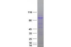 Validation with Western Blot