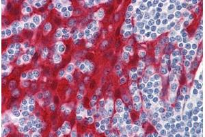 Human Tonsil: Formalin-Fixed, Paraffin-Embedded (FFPE)