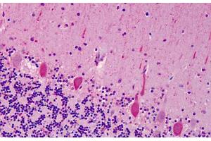 Human Cerebellum: Formalin-Fixed, Paraffin-Embedded (FFPE) (ACCN1 anticorps  (AA 15-26))