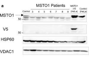 Pathogenic variants lead to MSTO1 protein instability.