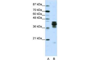 Western Blotting (WB) image for anti-Heterogeneous Nuclear Ribonucleoprotein D (HNRNPD) antibody (ABIN2462064)
