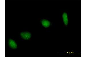 Immunofluorescence of purified MaxPab antibody to UBE2V1 on HeLa cell. (UBE2V1 anticorps  (AA 1-147))