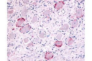 Anti-TRPA1 antibody IHC of human ganglion cells. (TRPA1 anticorps  (Internal Region))