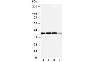 Western blot testing of Arg2 antibody and Lane 1:  rat lung;  2: (r) testis;  3: human A549;  4: (h) 293T cell lysate.