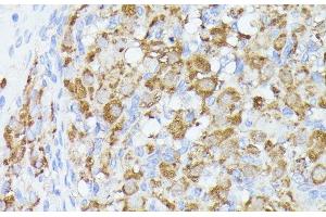 Immunohistochemistry of paraffin-embedded Rat ovary using ACAT2 Polyclonal Antibody at dilution of 1:100 (40x lens). (ACAT2 anticorps)