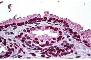 Human Prostate: Formalin-Fixed, Paraffin-Embedded (FFPE) (DLX2 anticorps  (AA 1-110))