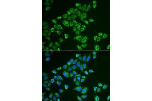 Immunofluorescence analysis of HeLa cells using TAC3 antibody.