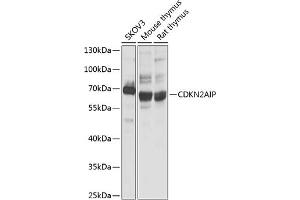 anti-CDKN2A Interacting Protein (CDKN2AIP) (AA 1-220) antibody