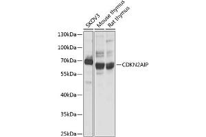 Western blot analysis of extracts of various cell lines, using CDKN2AIP antibody (ABIN1679162, ABIN3017622, ABIN3017623 and ABIN6220167) at 1:1000 dilution. (CDKN2AIP anticorps  (AA 1-220))