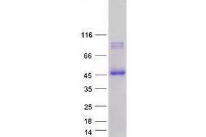 Validation with Western Blot
