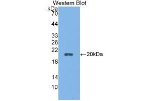 Detection of Recombinant CALY, Rat using Polyclonal Antibody to Calcyon Neuron Specific Vesicular Protein (CALY) (CALY anticorps  (AA 110-226))