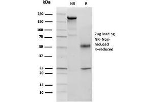 SDS-PAGE Analysis p57 Mouse Monoclonal Antibody (KIP2/880). (CDKN1C anticorps)
