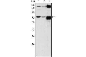 Western blot analysis using ATP2C1 mouse mAb against A431 (1), Hela (2) and HEK293 (3) cell lysate. (ATP2C1 anticorps)