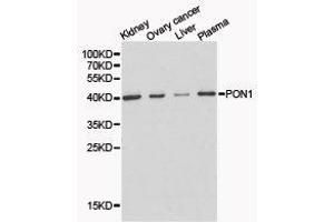 Western Blotting (WB) image for anti-Paraoxonase 1 (PON1) antibody (ABIN1874193) (PON1 anticorps)