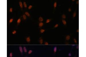 Immunofluorescence analysis of NIH-3T3 cells using USP33 Polyclonal Antibody at dilution of 1:100 (40x lens).