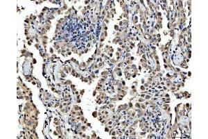 IHC analysis of FIP1L1 using anti-FIP1L1 antibody (ABIN7600761). (FIP1L1 anticorps  (AA 23-558))