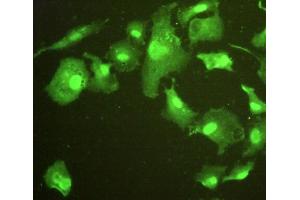 Figure:FITC staining on IHC-P;Simple: A549 cells.
