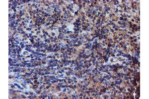 Image no. 7 for anti-Iduronate 2-Sulfatase (IDS) antibody (ABIN1498798)