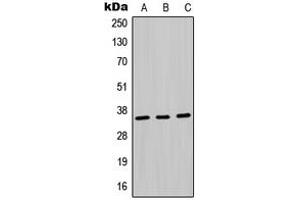 Western blot analysis of MDH1 expression in Jurkat (A), HepG2 (B), PC12 (C) whole cell lysates. (MDH1 anticorps  (Center))