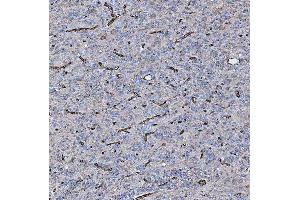 IHC analysis of PTRF/CAVIN1 using anti-PTRF/CAVIN1 antibody (ABIN7601817). (PTRF anticorps  (AA 47-390))