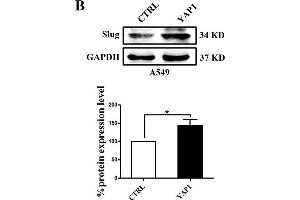 Slug is regulated by the co-transcriptional complex YAP1/TEAD in the EMT program of A549 cells. (GAPDH anticorps)