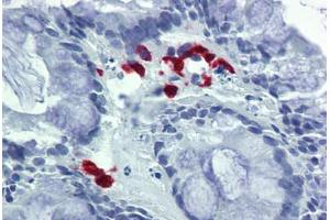 Human Colon: Formalin-Fixed, Paraffin-Embedded (FFPE)