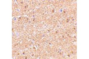 Immunohistochemistry of RTN4 in mouse brain tissue with RTN4 polyclonal antibody  at 2. (Reticulon 4 anticorps  (N-Term))