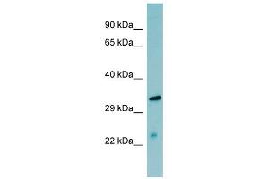 MASP2 antibody used at 1 ug/ml to detect target protein.