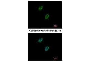 ICC/IF Image Immunofluorescence analysis of paraformaldehyde-fixed HeLa, using GABPB1, antibody at 1:500 dilution. (GABPB1 anticorps  (Center))