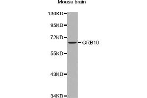 Western Blotting (WB) image for anti-Growth Factor Receptor-Bound Protein 10 (GRB10) (AA 1-100) antibody (ABIN5663731) (GRB10 anticorps  (AA 1-100))