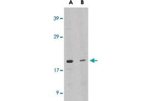 Western blot analysis of IL21 expression in HL-60 cell lysate in the absence (lane A) or presence of blocking peptide (lane B) with IL21 polyclonal antibody  at 1 ug /mL . (IL-21 anticorps  (Internal Region))