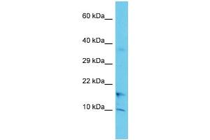 Host: Rabbit Target Name: COA1 Sample Type: Jurkat Whole Cell lysates Antibody Dilution: 1. (UBXN11 anticorps  (C-Term))